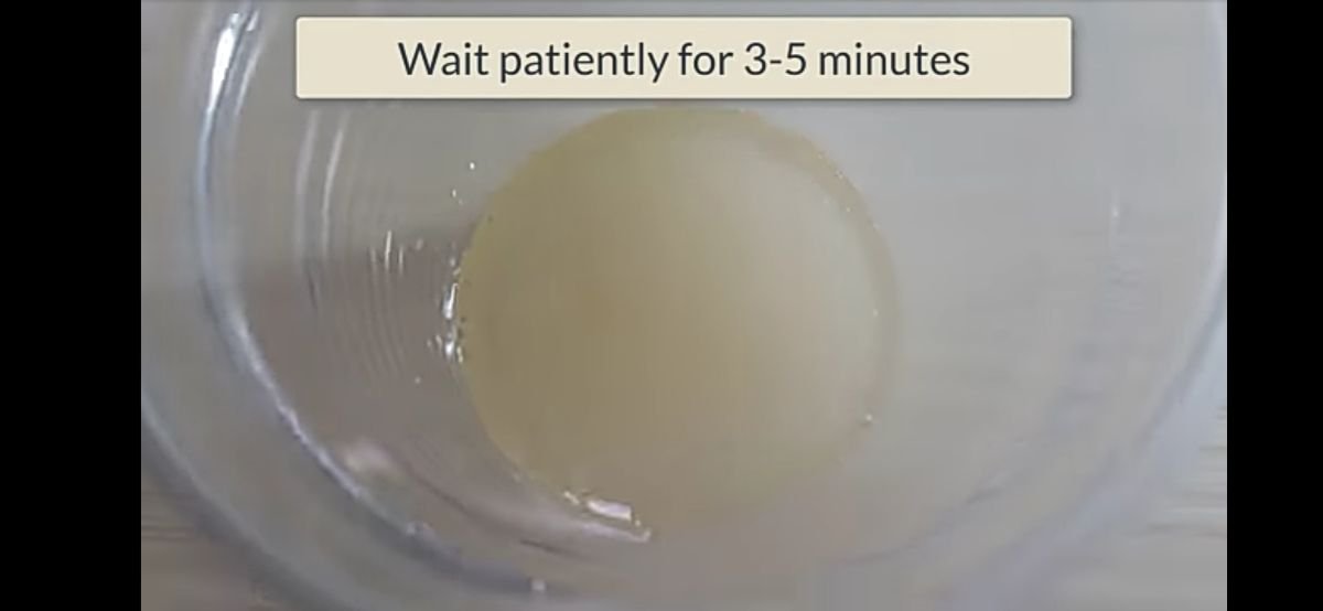 Do-it-yourself: Pregnancy Test With Sugar 3 Pregnancy test with sugar-4
