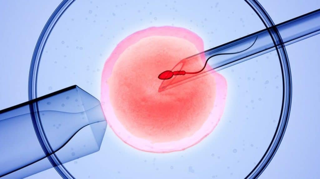 In Vitro Fertilization