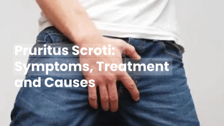 Pruritus Scroti Symptoms Treatment Causes