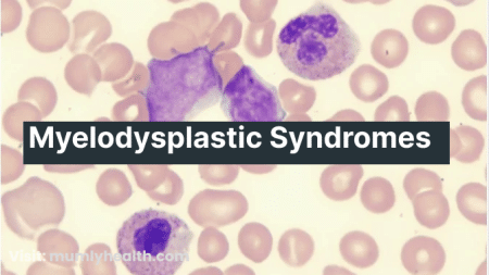 Myelodysplastic Syndromes